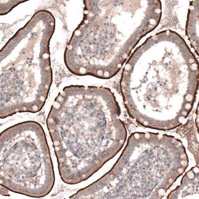 Immunohistochemistry-Paraffin: TSPAN13 Antibody [NBP1-81001]