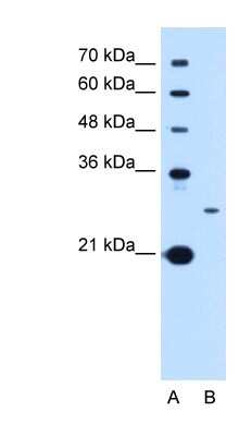 Western Blot: TSPAN15 Antibody [NBP1-62314]