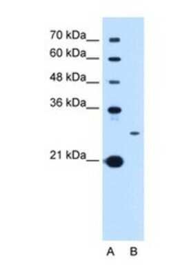 Western Blot: TSPAN15 Antibody [NBP1-69340]