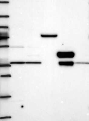 Western Blot: TSPAN15 Antibody [NBP3-17323]