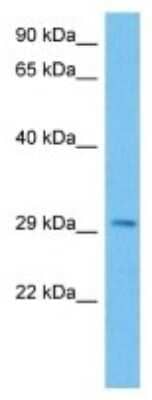 Western Blot: TSPAN18 Antibody [NBP3-10152]