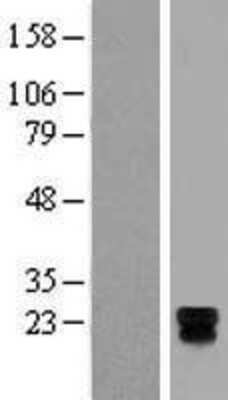 Western Blot: TSPAN18 Overexpression Lysate [NBL1-17371]