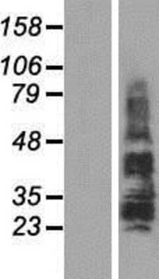 Western Blot: TSPAN18 Overexpression Lysate [NBP2-09962]