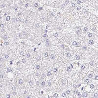 Immunohistochemistry: TSPAN19 Antibody [NBP2-34151]