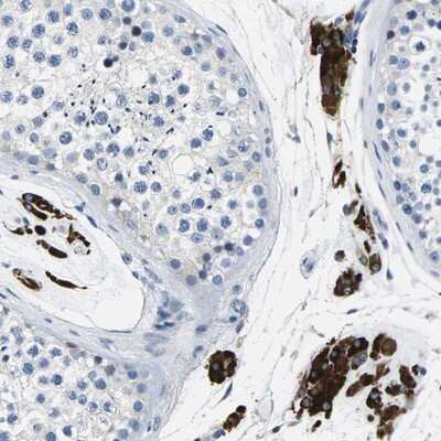 Immunohistochemistry-Paraffin: TSPAN2 Antibody [NBP1-87397]