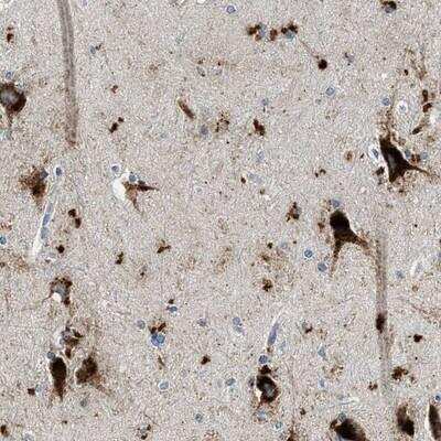 Immunohistochemistry-Paraffin: TSPAN3 Antibody [NBP1-80677]