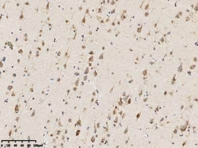 Immunohistochemistry: TSPAN3 Antibody [NBP3-14797]