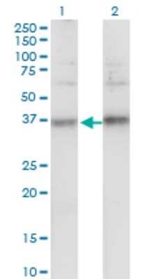 Western Blot: TSPAN32/TSSC6 Antibody (2B4) [H00010077-M02]