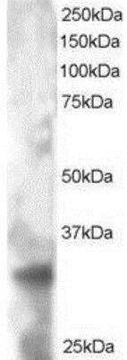 Western Blot: TSPAN32/TSSC6 Antibody [NB100-1035]