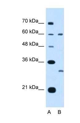 Western Blot: TSPAN32/TSSC6 Antibody [NBP1-62646]