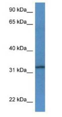 Western Blot: TSPAN33 Antibody [NBP1-74070]