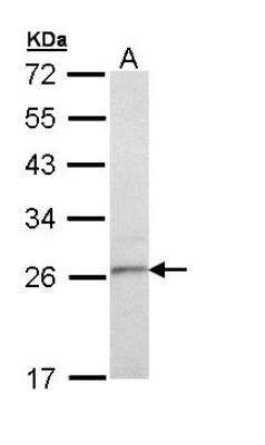 Western Blot: TSPAN6 Antibody [NBP1-31685]