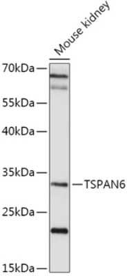 Western Blot: TSPAN6 AntibodyAzide and BSA Free [NBP2-94180]