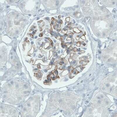 Immunohistochemistry-Paraffin: TSPAN7/TM4SF2 Antibody (CL0265) [NBP2-52895]