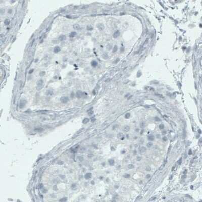 Immunohistochemistry-Paraffin: TSPAN7/TM4SF2 Antibody (CL0265) [NBP2-52895]