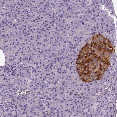 Immunohistochemistry-Paraffin: TSPAN7/TM4SF2 Antibody [NBP1-90310]