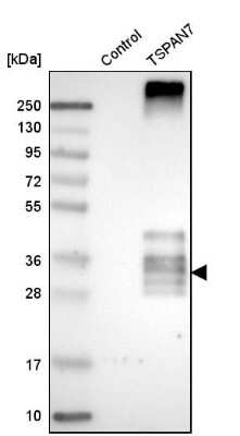 Western Blot: TSPAN7/TM4SF2 Antibody [NBP1-90310]