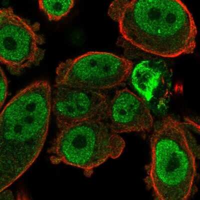 Immunocytochemistry/ Immunofluorescence: TSPAN8/TM4SF3 Antibody [NBP2-38529]