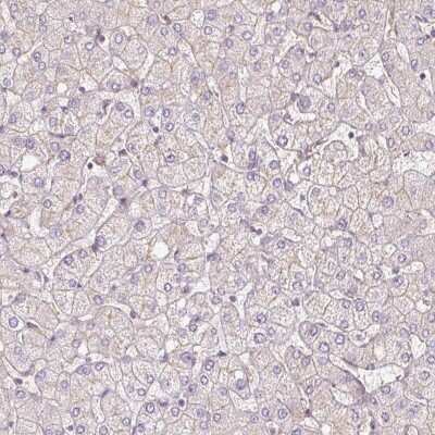 Immunohistochemistry-Paraffin: TSPAN8/TM4SF3 Antibody [NBP2-38529]