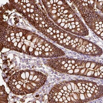 Immunohistochemistry-Paraffin: TSPAN8/TM4SF3 Antibody [NBP2-38529]