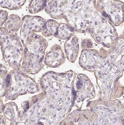 Immunohistochemistry-Paraffin: TSPAN8/TM4SF3 Antibody [NBP2-38529]
