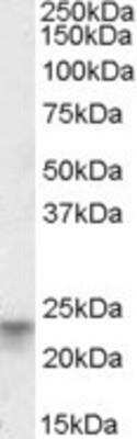 Western Blot: TSPAN8/TM4SF3 Antibody [NBP1-51942]