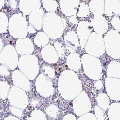 Immunohistochemistry-Paraffin: TSPEAR Antibody [NBP2-55659]