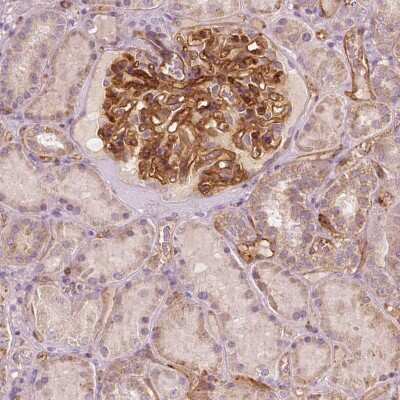 Immunohistochemistry: TSPO2 Antibody [NBP2-49501]