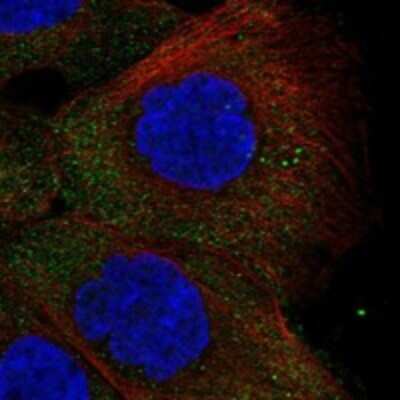 Immunocytochemistry/ Immunofluorescence: TSPY1 Antibody [NBP3-17556]