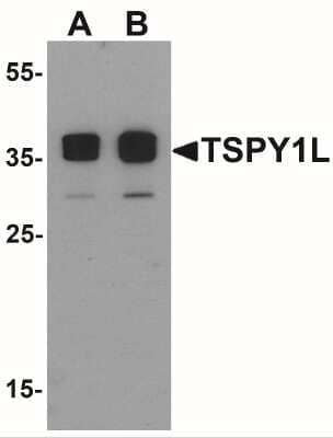 Western Blot: TSPY1 AntibodyBSA Free [NBP2-41198]