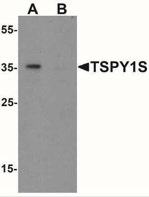 Western Blot: TSPY1 AntibodyBSA Free [NBP2-41199]