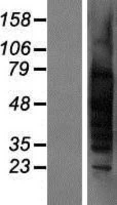 Western Blot: TSPY1 Overexpression Lysate [NBP2-08020]