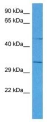 Western Blot: TSPY10 Antibody [NBP3-10070]