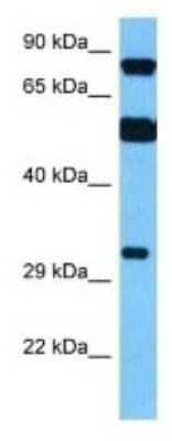 Western Blot: TSPY10 Antibody [NBP3-10097]