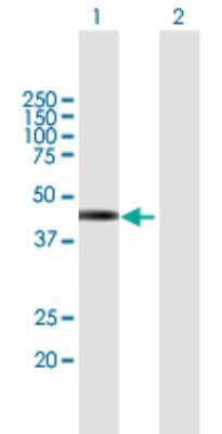 Western Blot: TSPY2 Antibody [H00064591-B01P]