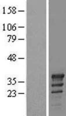 Western Blot: TSPY2 Overexpression Lysate [NBL1-17385]