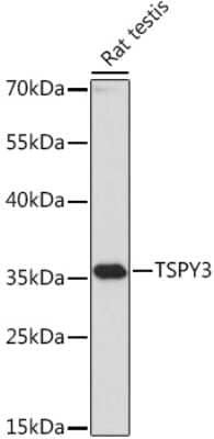 Western Blot: TSPY3 AntibodyAzide and BSA Free [NBP2-94457]