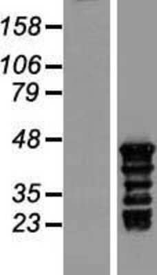 Western Blot: TSPY3 Overexpression Lysate [NBL1-12626]