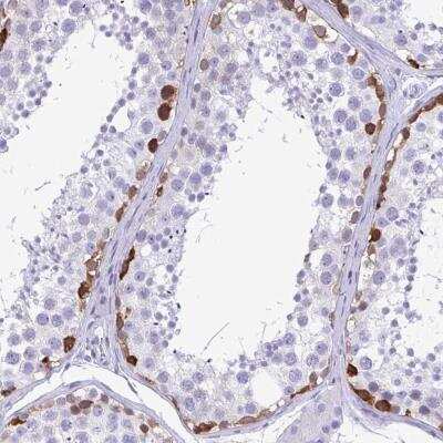 Immunohistochemistry: TSPY4 Antibody [NBP2-59797]