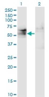 Western Blot: TSPYL1 Antibody (4F11) [H00007259-M01]