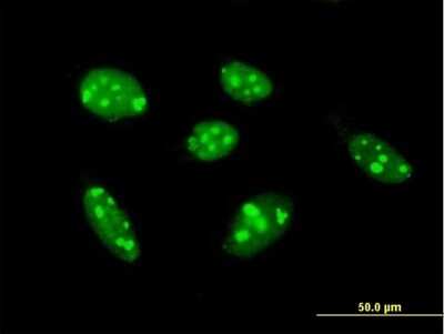 Immunocytochemistry/ Immunofluorescence: TSPYL1 Antibody [H00007259-B01P]