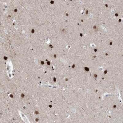 Immunohistochemistry: TSPYL1 Antibody [NBP2-38191]