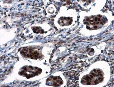 Immunohistochemistry-Paraffin: TSPYL1 Antibody [NBP1-33107]