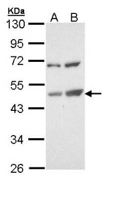 Western Blot: TSPYL1 Antibody [NBP1-33107]