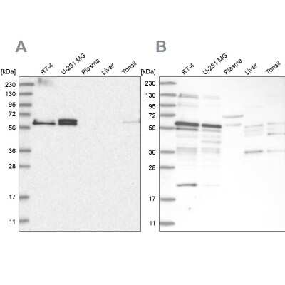 Western Blot: TSPYL1 Antibody [NBP2-38191]