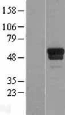 Western Blot: TSPYL1 Overexpression Lysate [NBL1-17386]