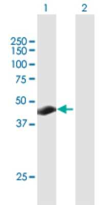 Western Blot: TSPYL3 Antibody [H00128854-B01P]