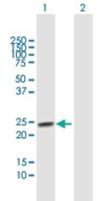 Western Blot: TSPYL4 Antibody [H00023270-B01P]