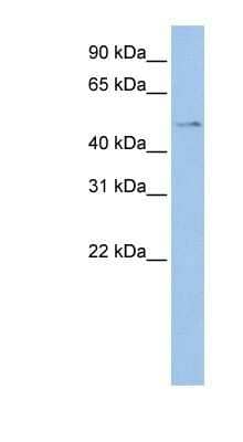 Western Blot: TSPYL4 Antibody [NBP1-56289]