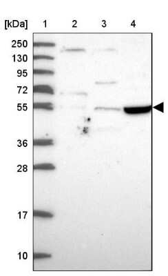 Western Blot: TSPYL4 Antibody [NBP1-92541]